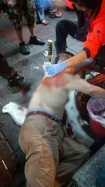 台湾街头发生械斗 男子被朋友持武士刀刺中后背 第1页