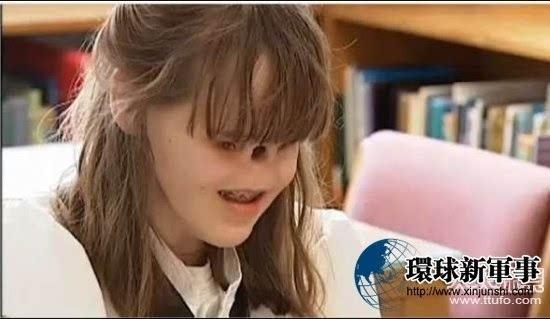 泰国女孩一头痛就七窍出血？盘点罕见怪病(6) 第6页