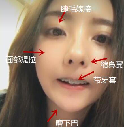 组图：王思聪前女友豆得儿脸部大调！秒变网红脸清纯不再 第1页